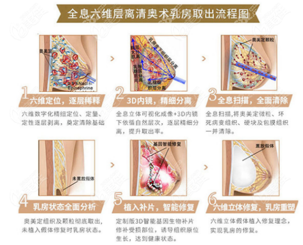 全息六维层离清奥技术