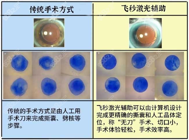 手术方式的不同