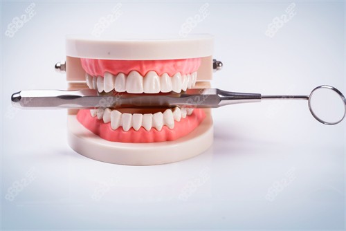 牙齿模型图