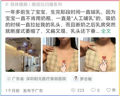 <!--<i data=20240705-sp></i>-->整形隆胸实例