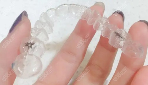 隐形牙套照片