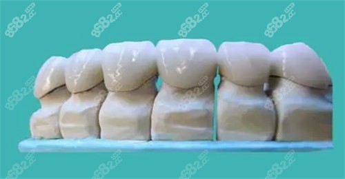 牙齿模具图 牙齿模具图