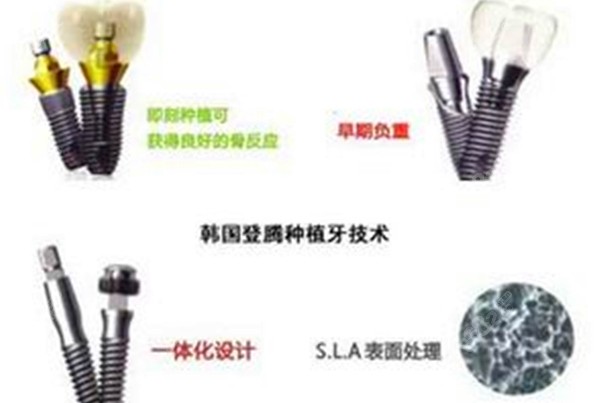 韩国登腾种植牙的图