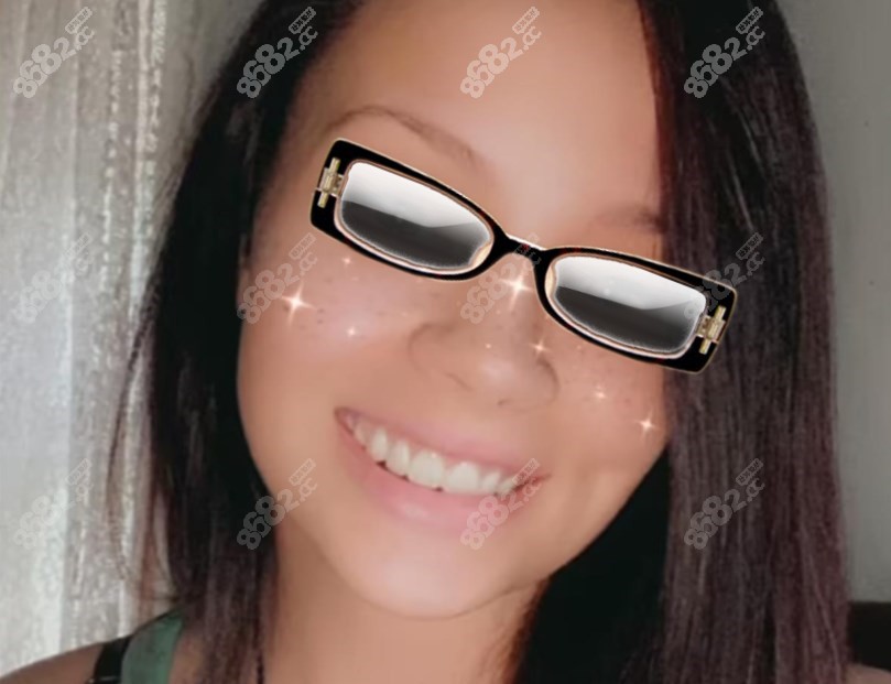 装了全口假牙的她笑容开朗，变得更漂亮了