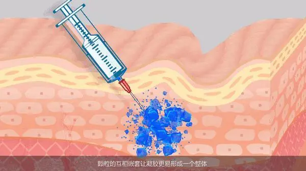 初黛玻尿酸维持多久