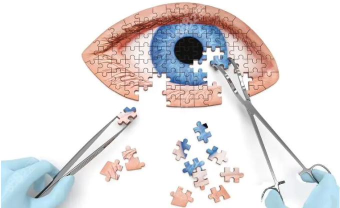 老年人白内障人工晶体哪种好www.8682.cc