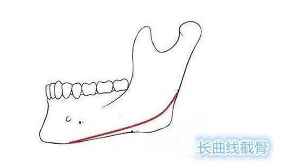 李继华磨骨怎么样？技术好吗