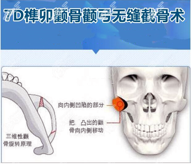 沈绍勇7D榫卯技术怎么样8682.cc