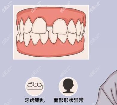 广大医院颌面外科怎么样?正颌正畸问题都可以解决