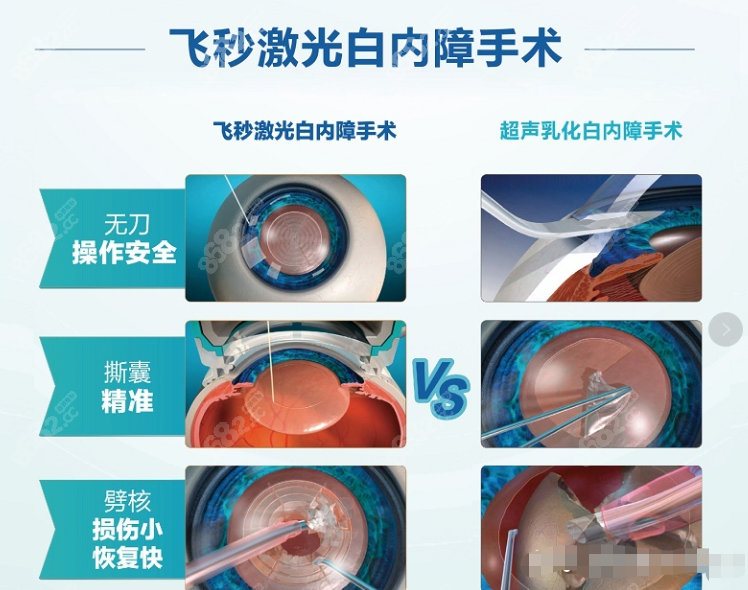 成都普瑞白内障手术价格5k起:人工晶体1500起,飞秒白内障加1w,近视眼 