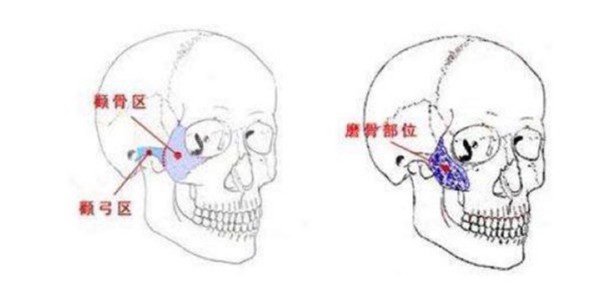 重庆颧骨颧弓内推医生有哪些？潘宝华/<!--<i data=20240705-sp></i>-->/<!--<i data=20240705-sp></i>-->不错