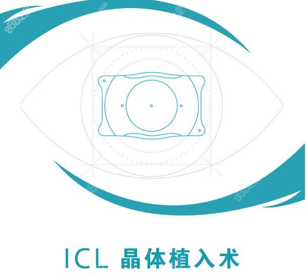 成都icl晶体植入价格2023