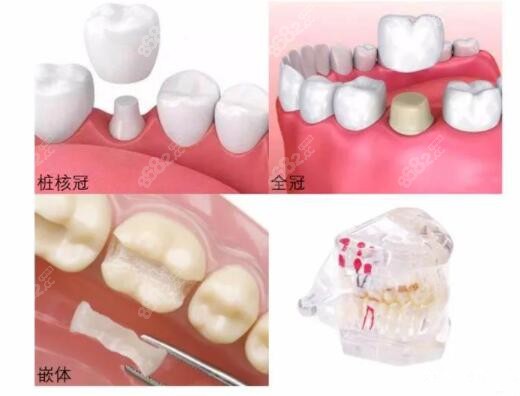 南阳社旗县看牙补牙哪里好