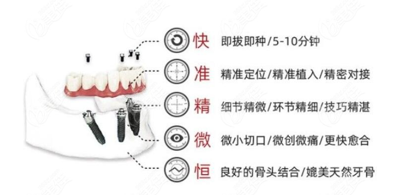 微创种植牙优点和缺点