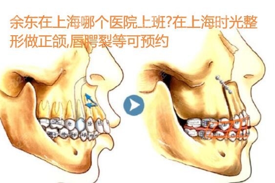 在上海哪个医院上班?在时光整形做正颌,唇腭裂等可预约