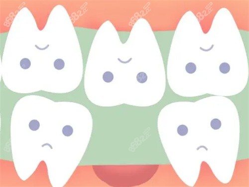  上海拔牙多少钱