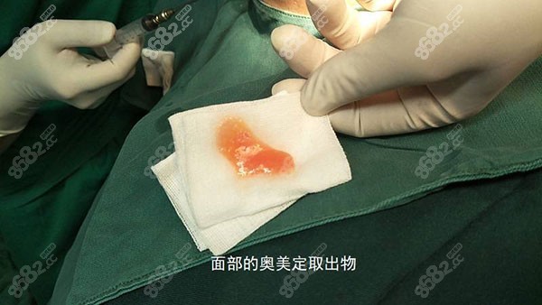 林彪斌医生名气大吗