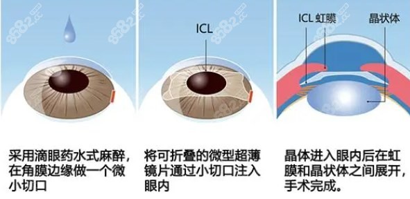 南昌普瑞眼科周文天怎么样