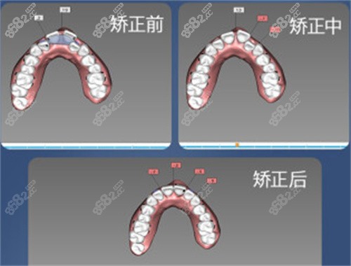 牙齿数据分析图