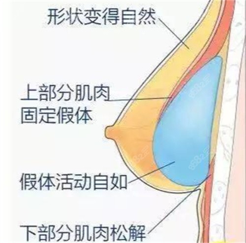 武汉艺星徐国建双平面技术