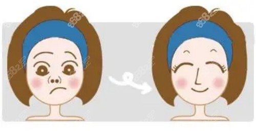 北京艺星整形医院怎么样？
