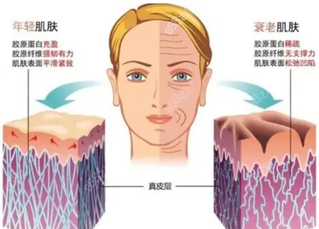 注射双美胶原蛋白真实体验