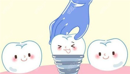 郑州中诺口腔医院做种植牙怎么样？