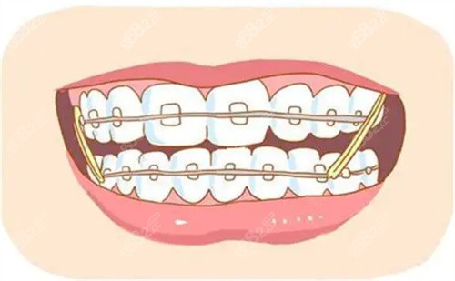 昆明柏德口腔青少儿牙齿矫正怎么样?