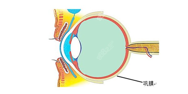 后巩膜加固术价格表8682.cc