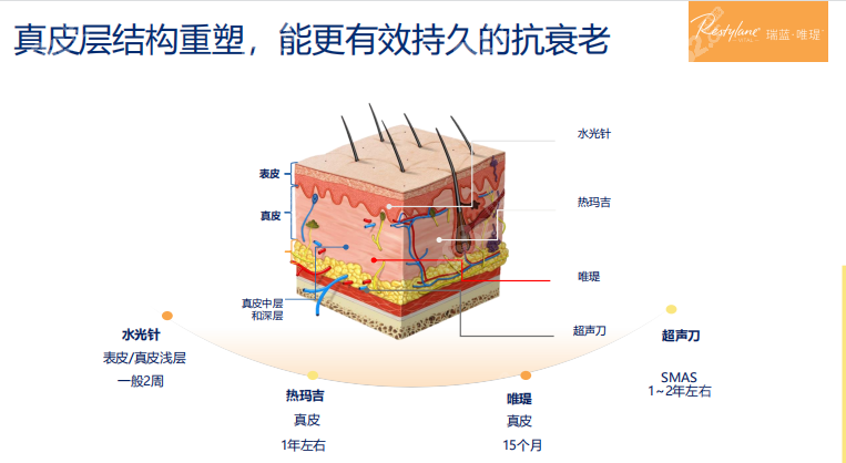 瑞蓝唯瑅水光玻尿酸的优势点