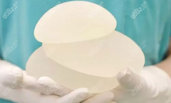 美国曼托假体怎么样