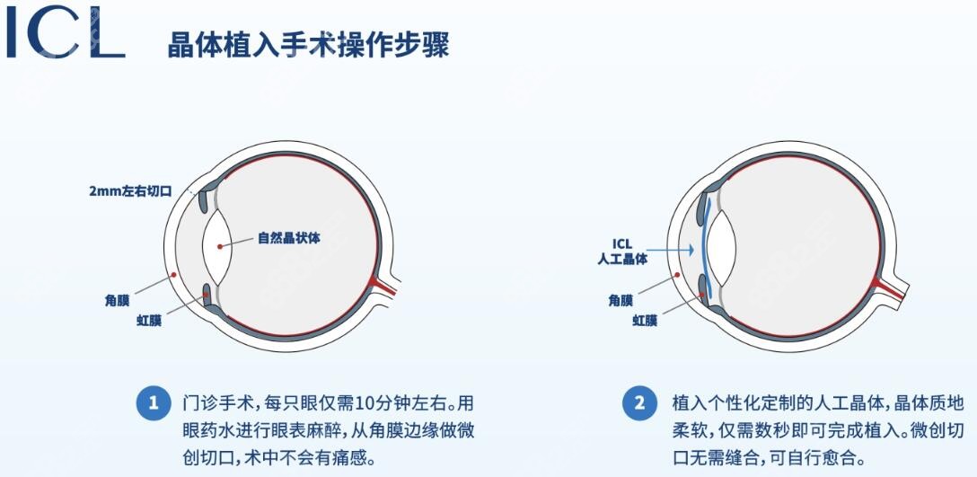 爱尔眼科医院地址