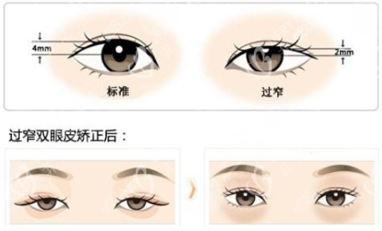 徐晓斐是不是<!--<i data=20240705-sp></i>-->的