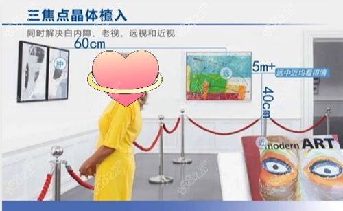 多焦点人工晶体品牌及价格表