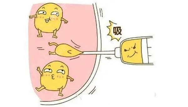 北京联合丽格吸脂怎么样？冯庆亮院长做吸脂评价很不错