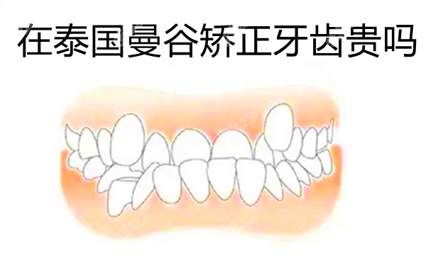 在泰国曼谷矫正牙齿贵吗