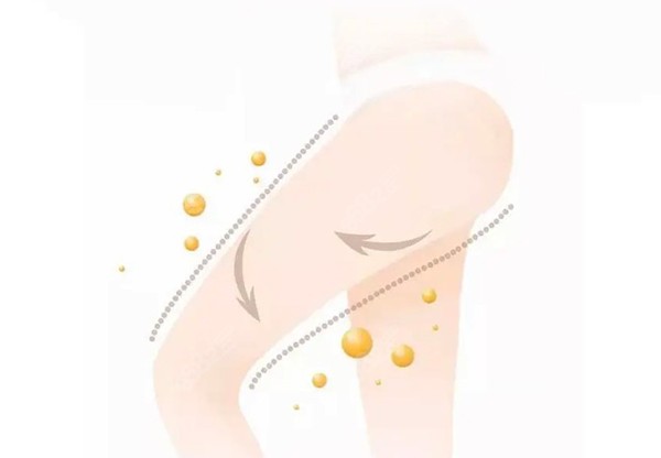 北京联合丽格吸脂怎么样？冯庆亮院长做吸脂评价很不错