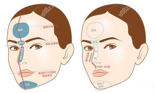 西安西美整形医院假体隆鼻价格多少钱？