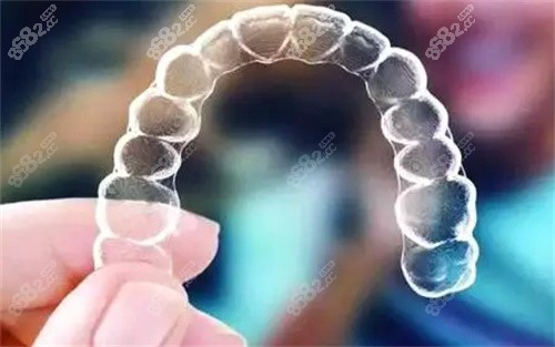 隐形牙套照片
