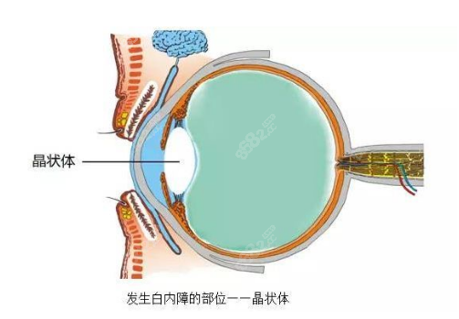 郑州白内障手术医院排名榜前10名