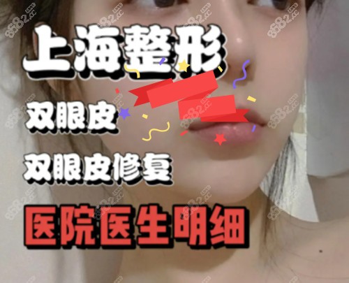 上海雙眼皮修復好還是徐曉斐