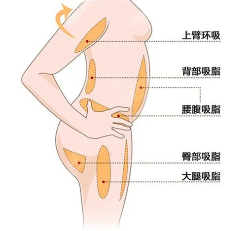 我150斤抽脂抽了30斤花了10万