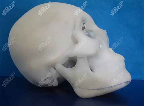 3D打印人体头骨图