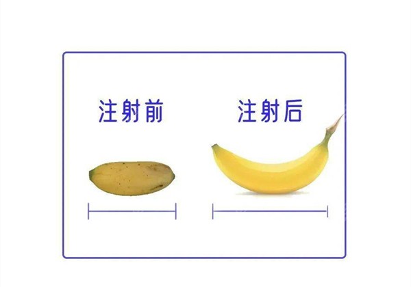 玻尿酸增粗