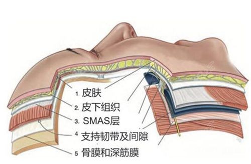 李晓东医生做面部提升手术有哪些优势