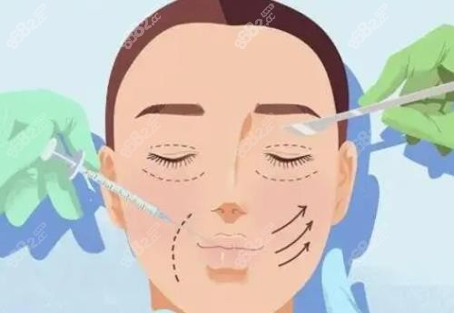 杭州時(shí)光黃良飛醫(yī)生做眼睛怎么樣