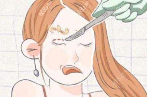 杭州時(shí)光黃良飛醫(yī)生做眼睛怎么樣