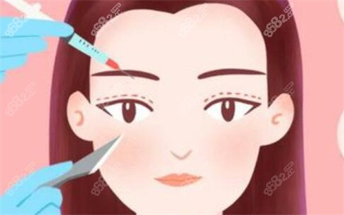 哈尔滨亿术医疗美容收费标准