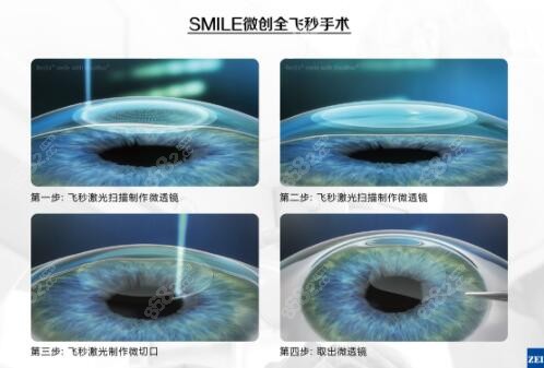 惠州希玛眼科医院和爱尔眼科哪个好