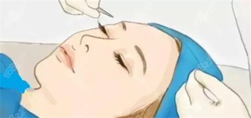 哈尔滨亿术医疗美容收费标准